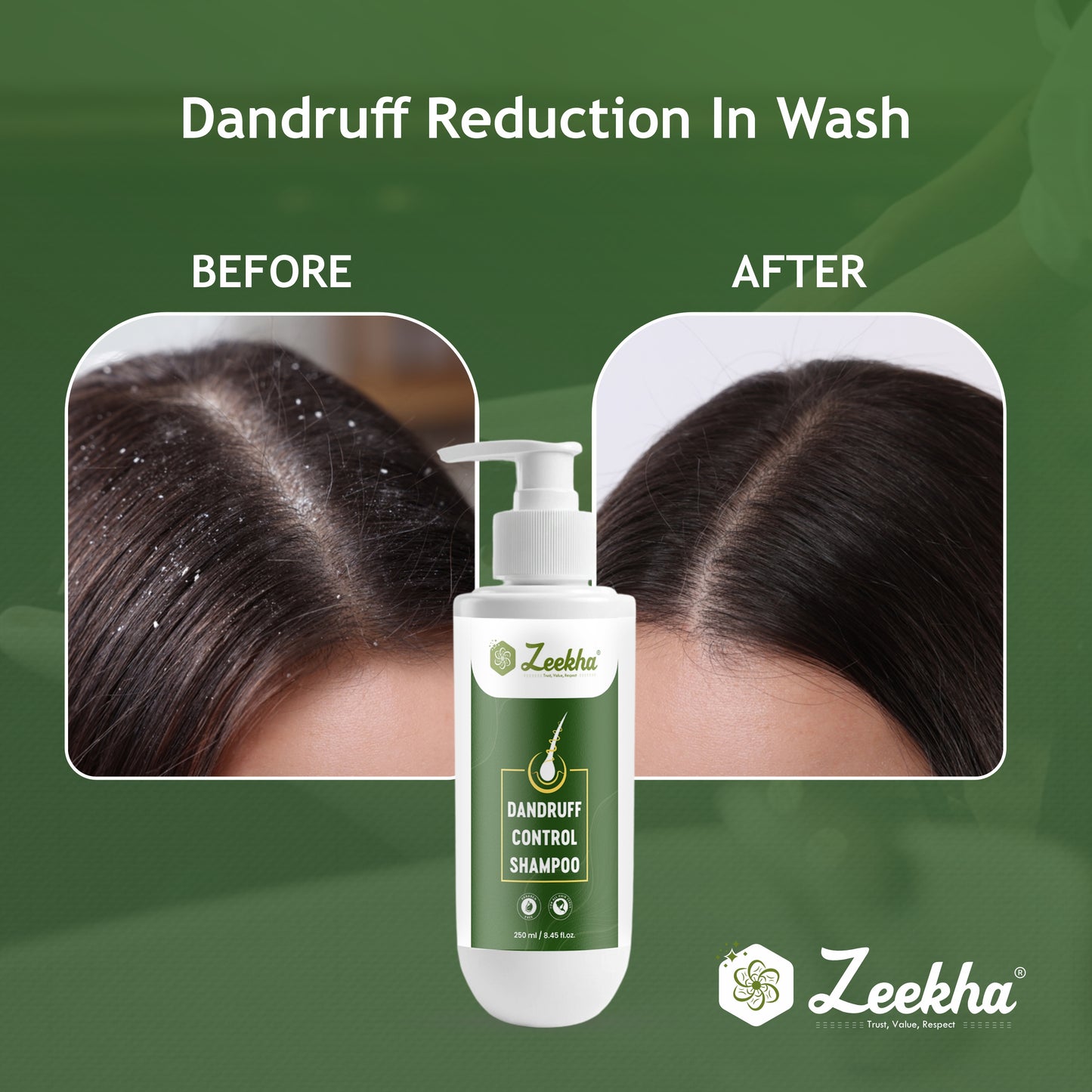 ZEEKHA Anti Dandruff Shampoo | Reduces Up to 100% Dandruff and Strengthens Hair result in 6-8 wash  | Derma Approved Shampoo with Salicylic & Biotin | Shampoo For All Hair types | For Women And Men | 250ml